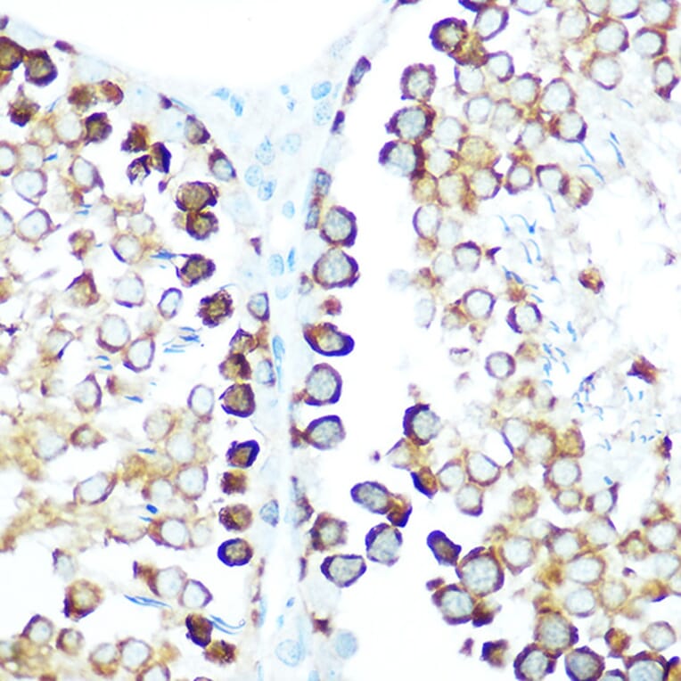 Immunohistochemistry - Anti-STIP1/STI1 Antibody (A90925) - Antibodies.com