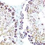 Immunohistochemistry - Anti-STIP1/STI1 Antibody (A90925) - Antibodies.com