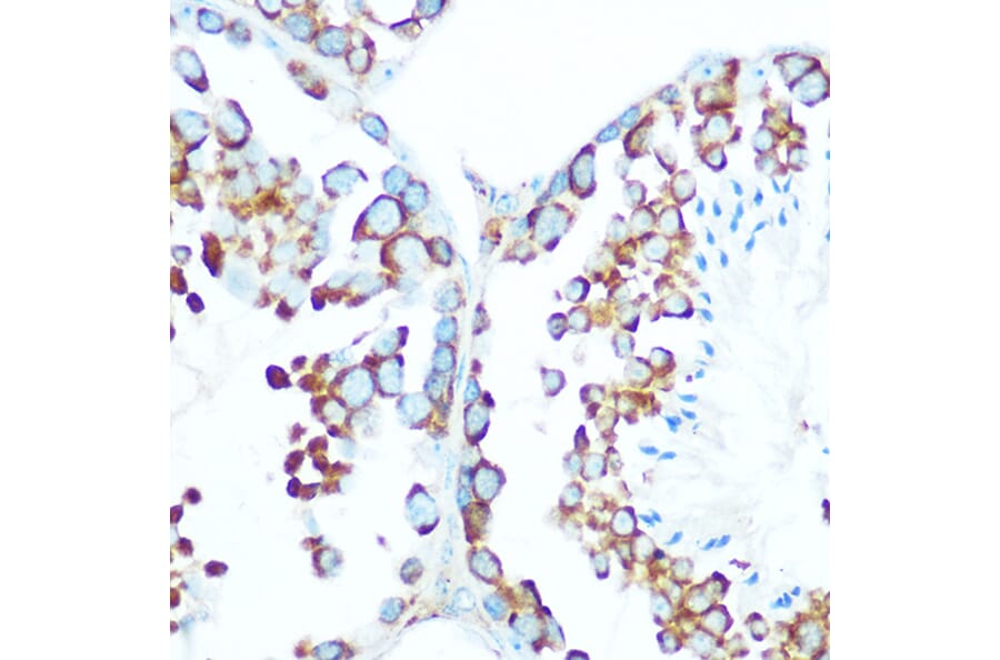 Immunohistochemistry - Anti-STIP1/STI1 Antibody (A90925) - Antibodies.com