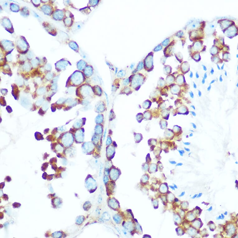 Immunohistochemistry - Anti-STIP1/STI1 Antibody (A90925) - Antibodies.com