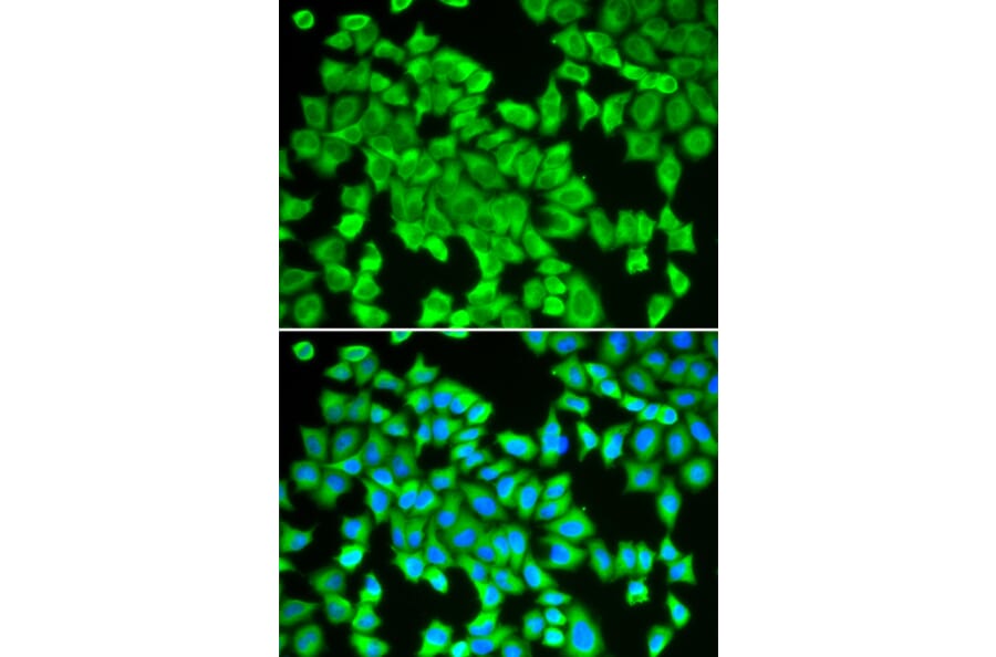 Immunofluorescence - Anti-STIP1/STI1 Antibody (A90925) - Antibodies.com