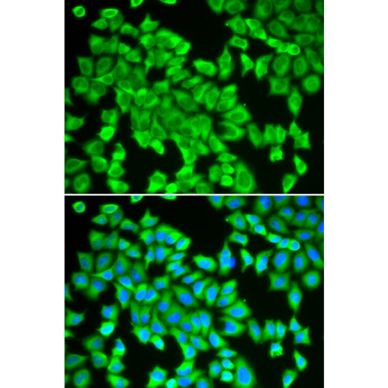 Immunofluorescence - Anti-STIP1/STI1 Antibody (A90925) - Antibodies.com