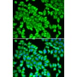 Immunofluorescence - Anti-STIP1/STI1 Antibody (A90925) - Antibodies.com
