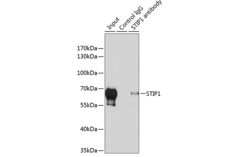 Western Blot - Anti-STIP1/STI1 Antibody (A90925) - Antibodies.com