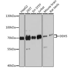 Western Blot - Anti-DDX5 Antibody (A90926) - Antibodies.com