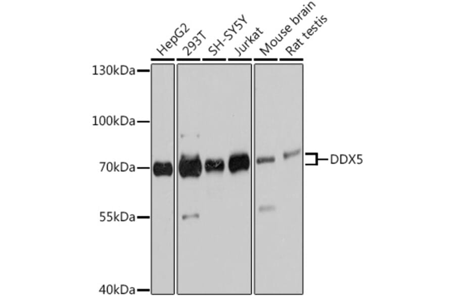 Western Blot - Anti-DDX5 Antibody (A90926) - Antibodies.com