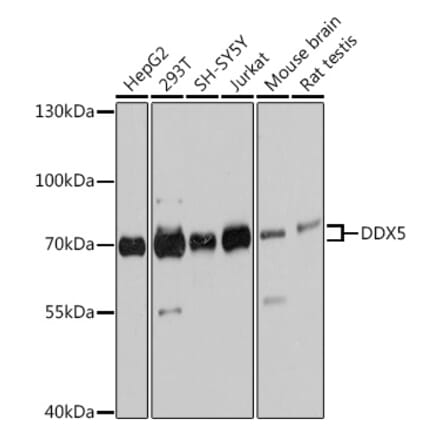 Western Blot - Anti-DDX5 Antibody (A90926) - Antibodies.com