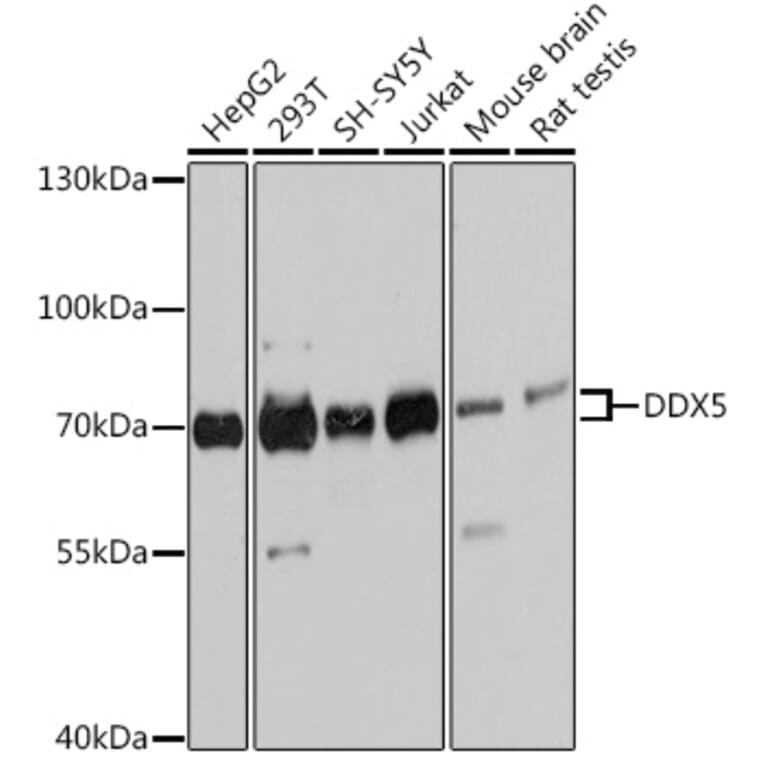 Western Blot - Anti-DDX5 Antibody (A90926) - Antibodies.com