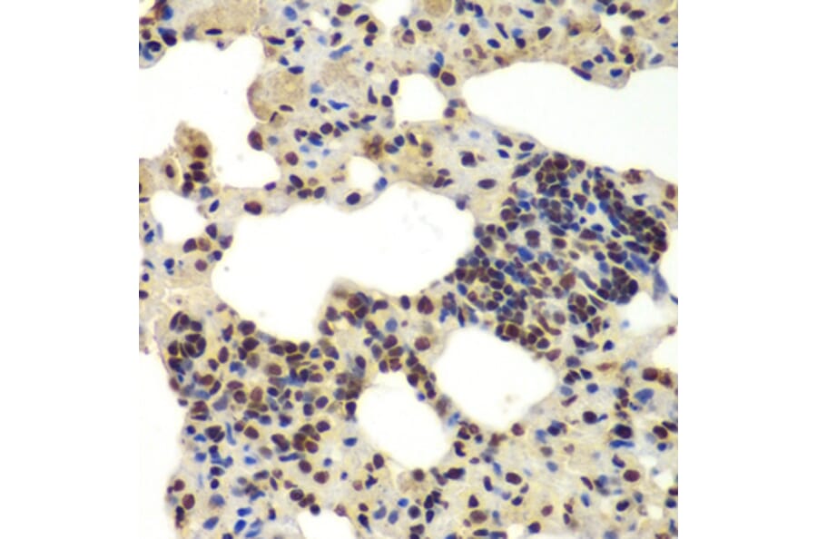 Immunohistochemistry - Anti-DDX5 Antibody (A90926) - Antibodies.com
