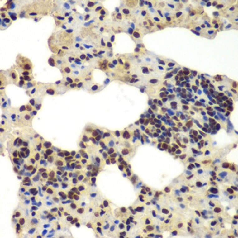 Immunohistochemistry - Anti-DDX5 Antibody (A90926) - Antibodies.com