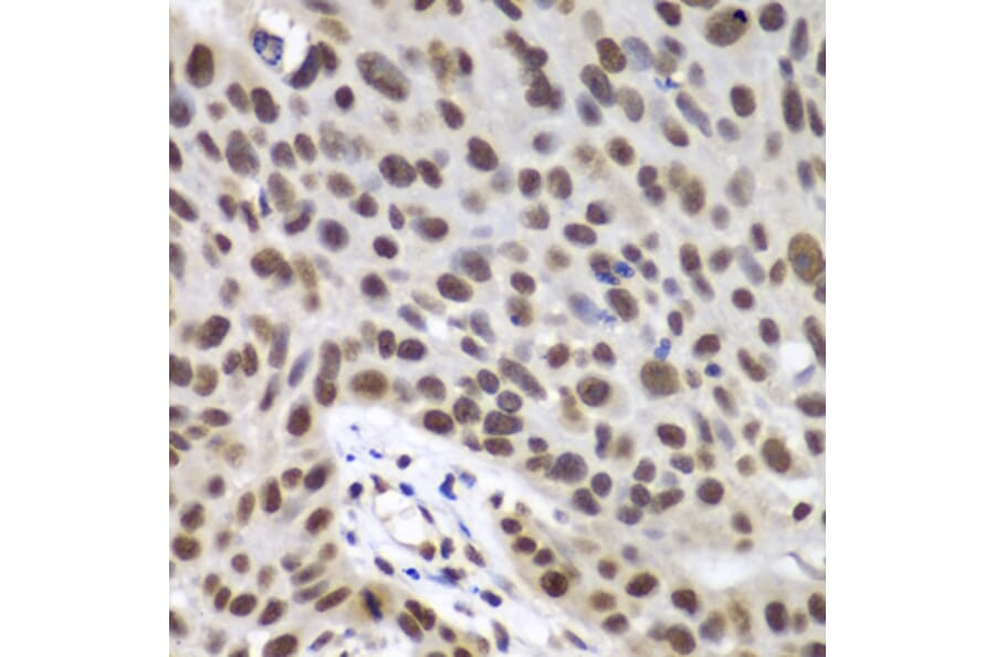 Immunohistochemistry - Anti-DDX5 Antibody (A90926) - Antibodies.com