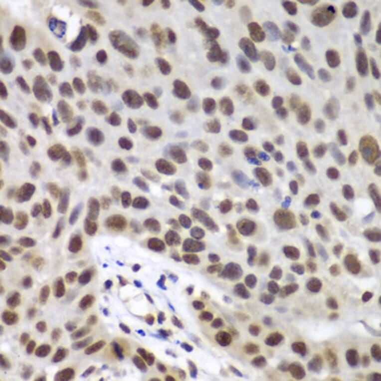 Immunohistochemistry - Anti-DDX5 Antibody (A90926) - Antibodies.com