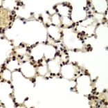 Immunohistochemistry - Anti-DDX5 Antibody (A90926) - Antibodies.com