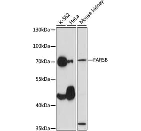 Western Blot - Anti-FARSLB Antibody (A90927) - Antibodies.com