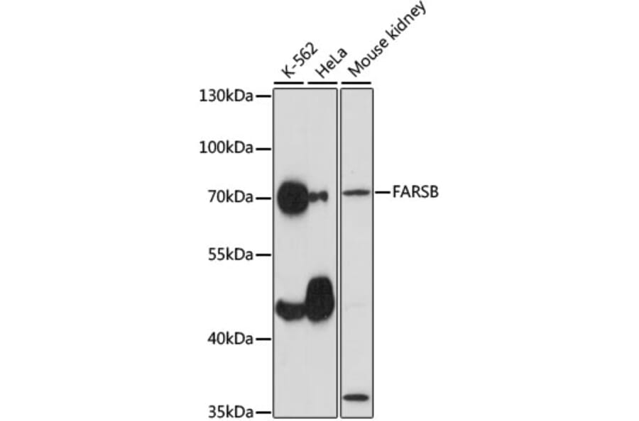 Western Blot - Anti-FARSLB Antibody (A90927) - Antibodies.com