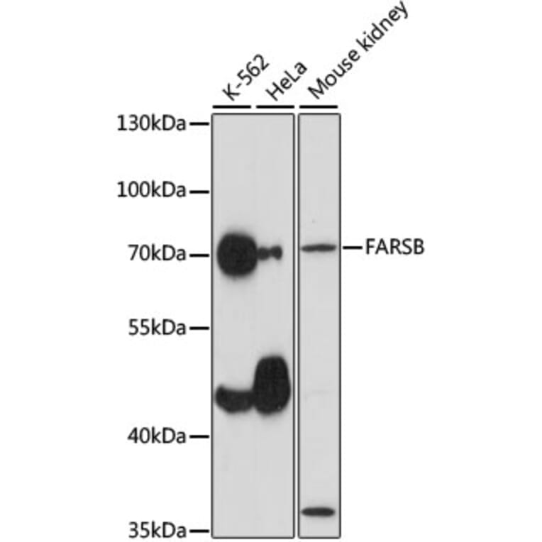 Western Blot - Anti-FARSLB Antibody (A90927) - Antibodies.com