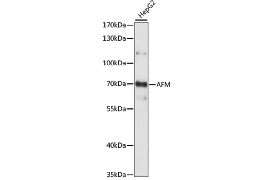 Western Blot - Anti-AFM Antibody (A90928) - Antibodies.com