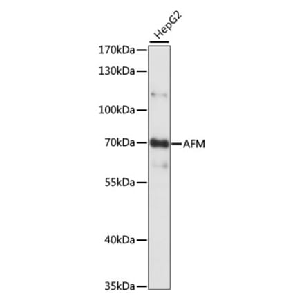 Western Blot - Anti-AFM Antibody (A90928) - Antibodies.com