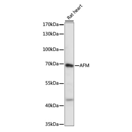 Western Blot - Anti-AFM Antibody (A90929) - Antibodies.com
