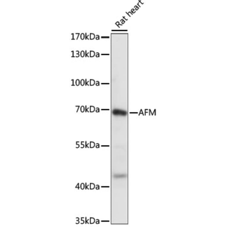 Western Blot - Anti-AFM Antibody (A90929) - Antibodies.com