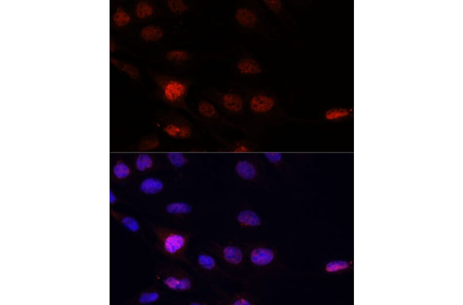 Immunofluorescence - Anti-KLHL8 Antibody (A90930) - Antibodies.com