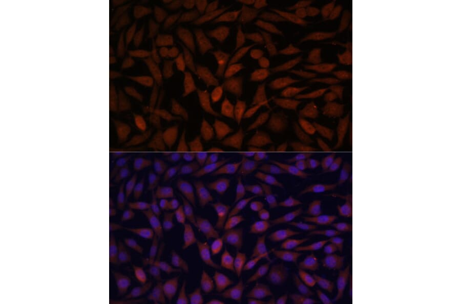 Immunofluorescence - Anti-KLHL8 Antibody (A90930) - Antibodies.com