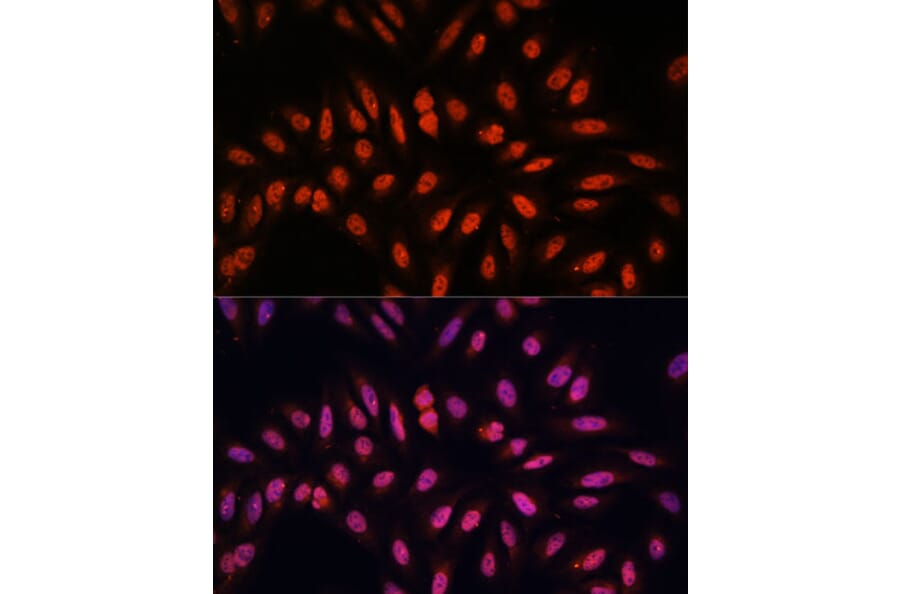Immunofluorescence - Anti-KLHL8 Antibody (A90930) - Antibodies.com
