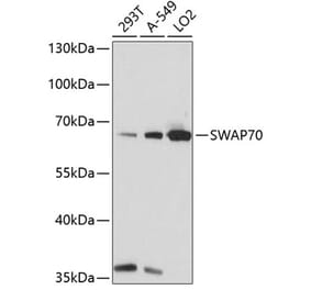 Western Blot - Anti-SWAP70 Antibody (A90932) - Antibodies.com