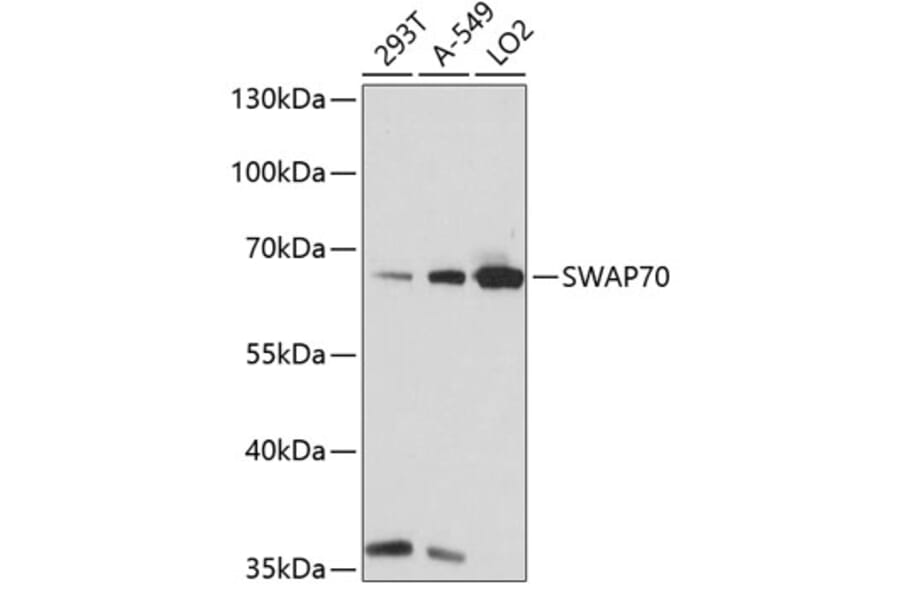Western Blot - Anti-SWAP70 Antibody (A90932) - Antibodies.com