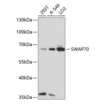 Western Blot - Anti-SWAP70 Antibody (A90932) - Antibodies.com