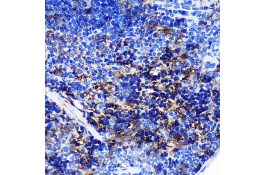 Immunohistochemistry - Anti-SWAP70 Antibody (A90932) - Antibodies.com