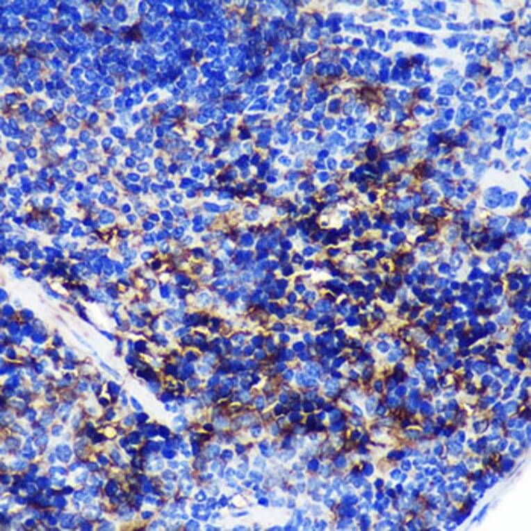 Immunohistochemistry - Anti-SWAP70 Antibody (A90932) - Antibodies.com
