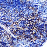 Immunohistochemistry - Anti-SWAP70 Antibody (A90932) - Antibodies.com