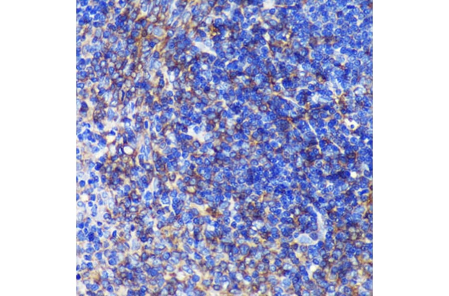Immunohistochemistry - Anti-SWAP70 Antibody (A90932) - Antibodies.com
