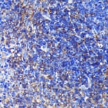Immunohistochemistry - Anti-SWAP70 Antibody (A90932) - Antibodies.com