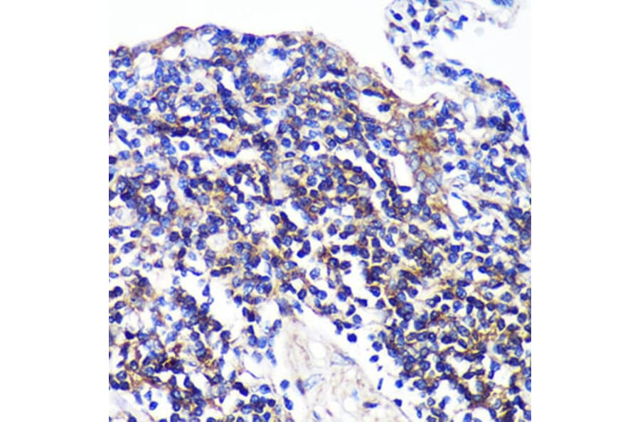 Immunohistochemistry - Anti-SWAP70 Antibody (A90932) - Antibodies.com