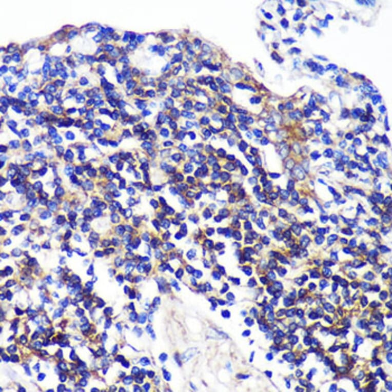 Immunohistochemistry - Anti-SWAP70 Antibody (A90932) - Antibodies.com