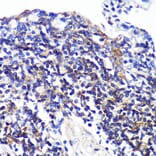 Immunohistochemistry - Anti-SWAP70 Antibody (A90932) - Antibodies.com