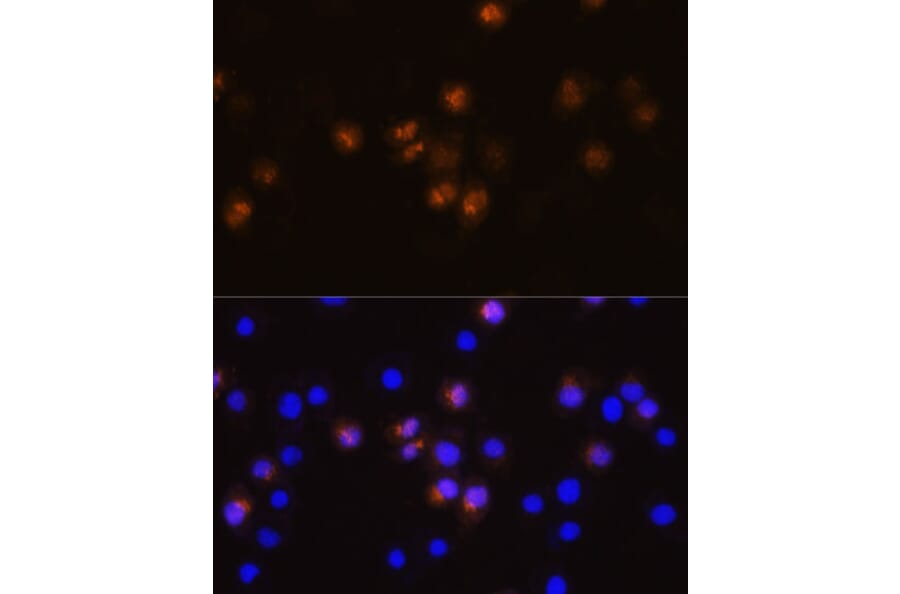Immunofluorescence - Anti-SWAP70 Antibody (A90932) - Antibodies.com