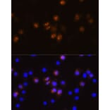 Immunofluorescence - Anti-SWAP70 Antibody (A90932) - Antibodies.com