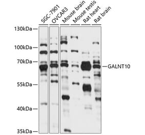 Western Blot - Anti-GALNT10 Antibody (A90933) - Antibodies.com