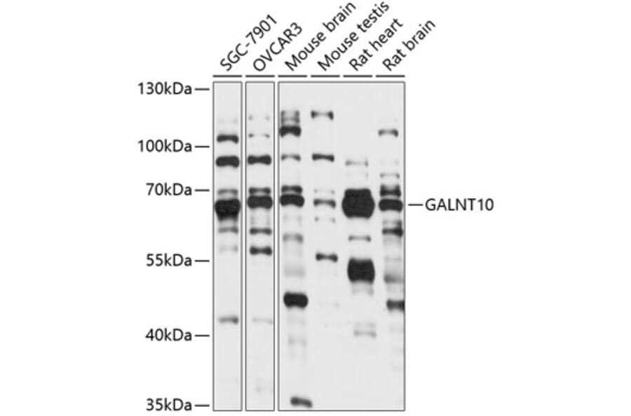 Western Blot - Anti-GALNT10 Antibody (A90933) - Antibodies.com