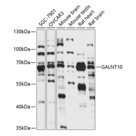 Western Blot - Anti-GALNT10 Antibody (A90933) - Antibodies.com