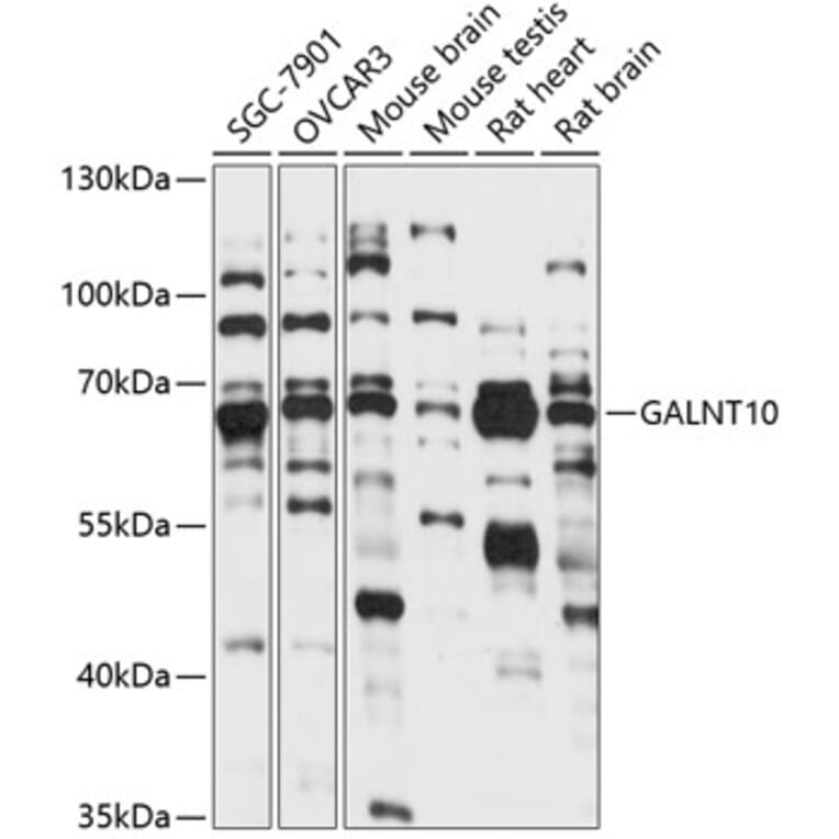 Western Blot - Anti-GALNT10 Antibody (A90933) - Antibodies.com