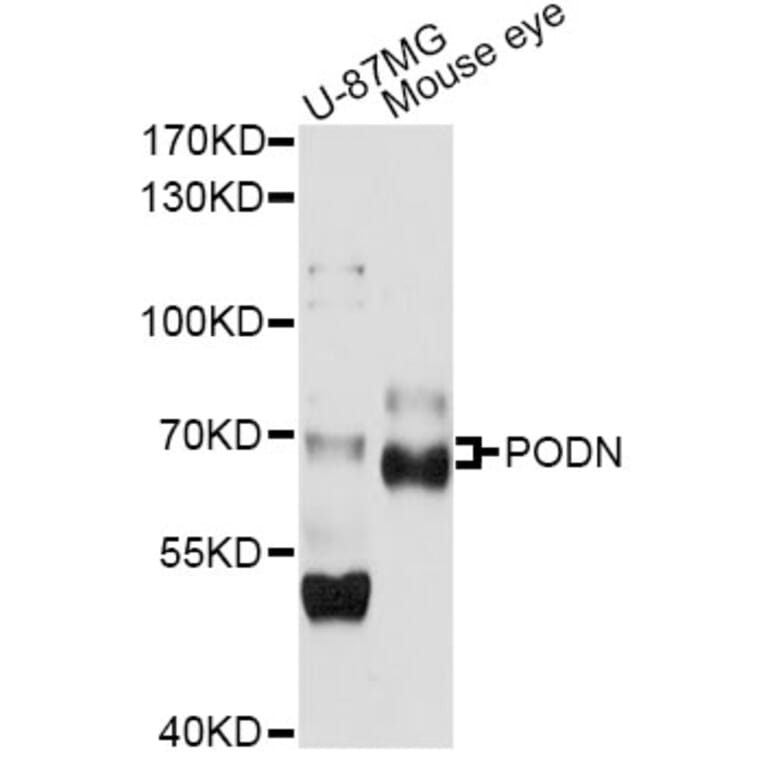 Western Blot - Anti-PODN Antibody (A14309) - Antibodies.com