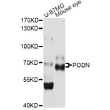 Western Blot - Anti-PODN Antibody (A14309) - Antibodies.com