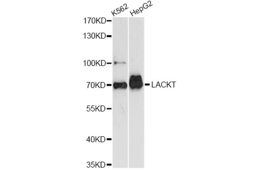 Western Blot - Anti-ASH2L Antibody (A14543) - Antibodies.com