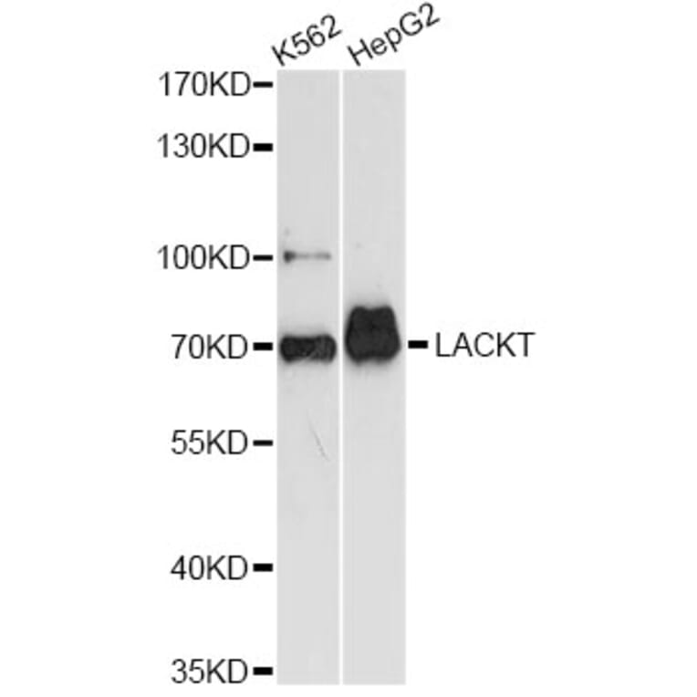 Western Blot - Anti-ASH2L Antibody (A14543) - Antibodies.com