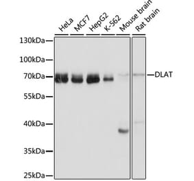 Western Blot - Anti-Pyruvate Dehydrogenase E2 Antibody (A90937) - Antibodies.com
