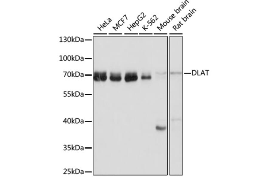 Western Blot - Anti-Pyruvate Dehydrogenase E2 Antibody (A90937) - Antibodies.com